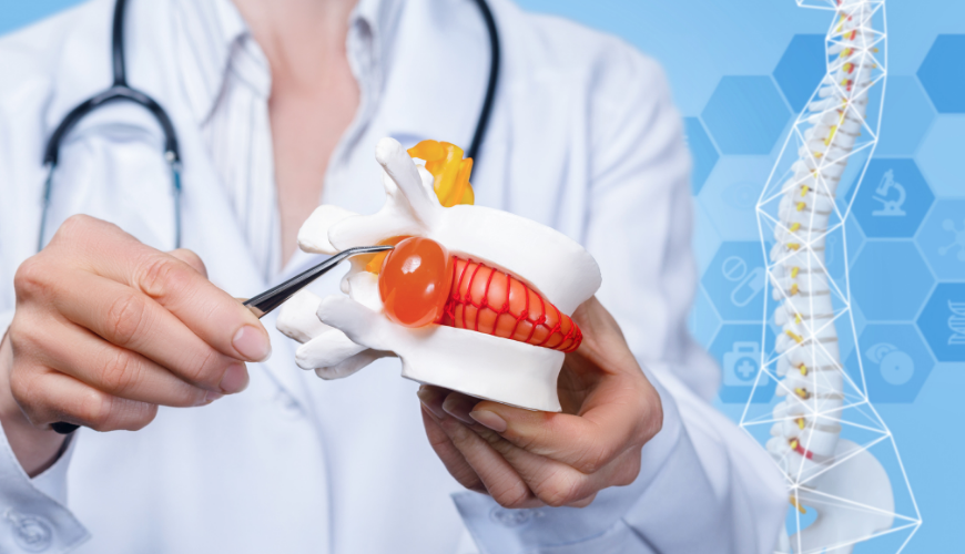 Co wpływa na wysokość odszkodowania za uszkodzony dysk w kręgosłupie w świadczeniach pracowniczych?